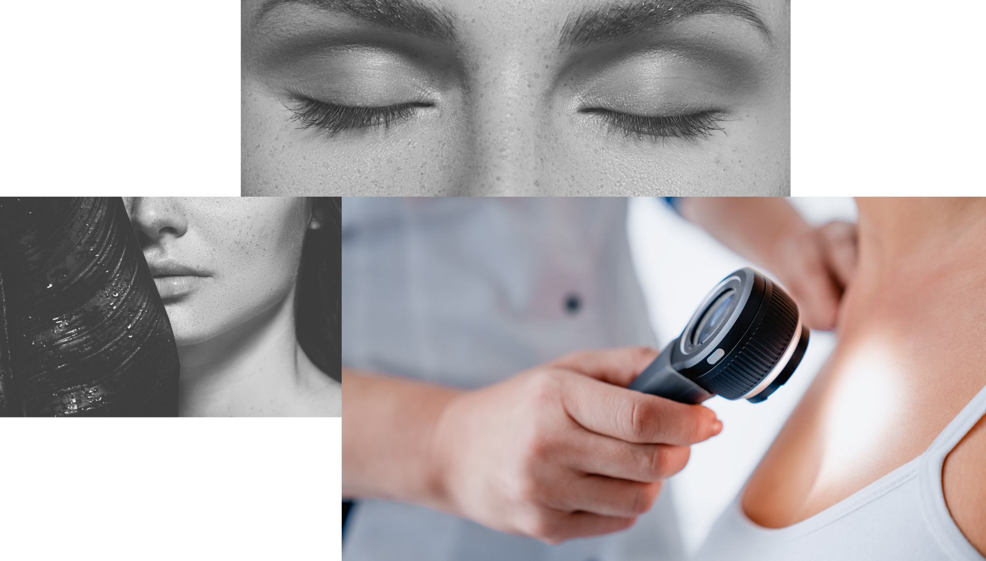 Collage over omniderm